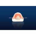 3D Printed Full Denture